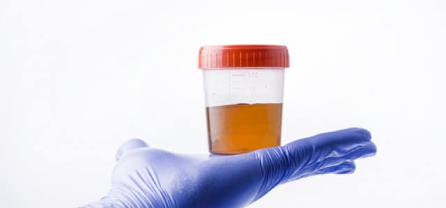 Top Reasons Why Drug and Alcohol Testing is Important for Your Business